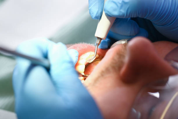 Best Emergency Dental Care for Sports Injuries in Hernando, FL